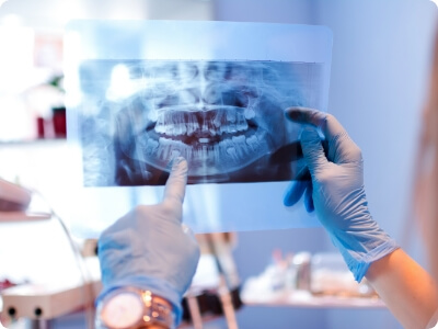 Dentist looking at digital x rays