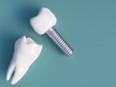 dental implants against a green background