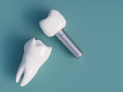 a dental implant against a green background